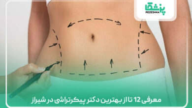 بهترین دکتر پیکرتراشی در شیراز