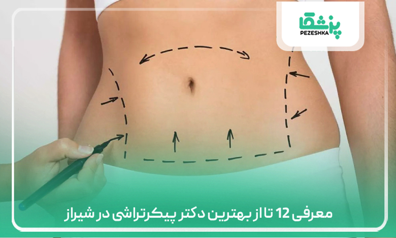 بهترین دکتر پیکرتراشی در شیراز