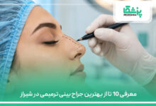 معرفی 10 تا از بهترین جراح بینی ترمیمی در شیراز