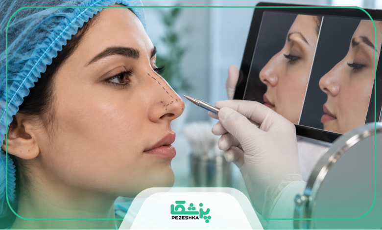 بعد از جراحی بینی ترمیمی در شیراز باید به چه نکاتی توجه کرد ؟