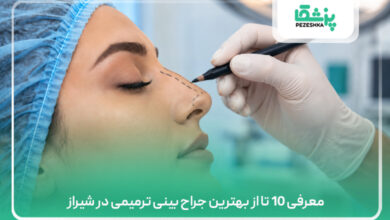 معرفی 10 تا از بهترین جراح بینی ترمیمی در شیراز