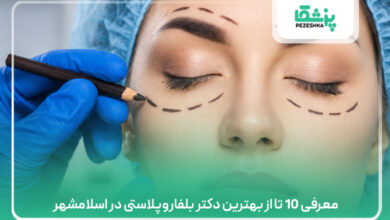 معرفی 10 تا از بهترین دکتر بلفاروپلاستی در اسلامشهر