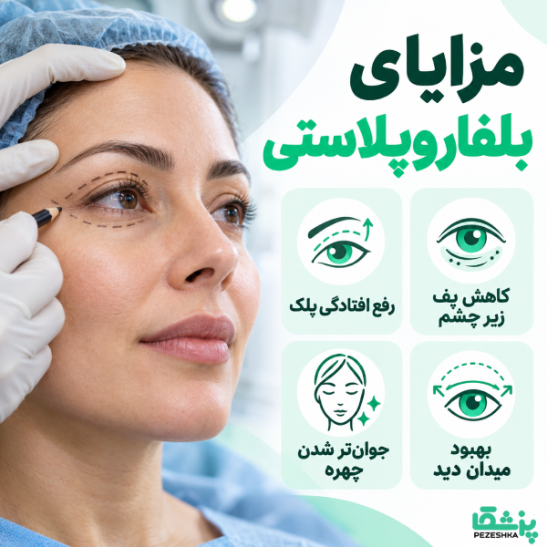 مزایای بلفاروپلاستی